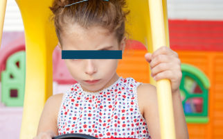 Sindrome della X Fragile